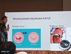 RS Premier Bintaro Edukasi dan Tawarkan Bedah Jantung Dengan Teknologi Medis Terkini